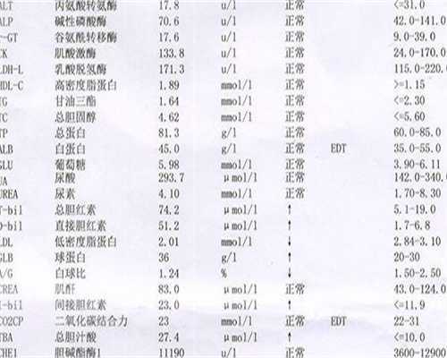 无锡单身女性必看；精索静脉曲张不育的试管婴儿避坑指南