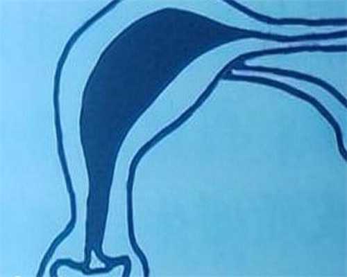 女性不孕症状