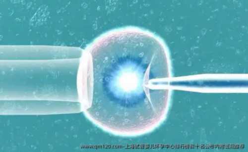 男性不孕检查