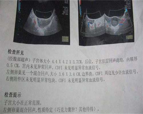 无锡供卵助孕攻略？卵巢性不孕家庭避坑指南